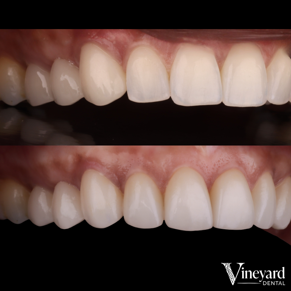 Vineyard Dental